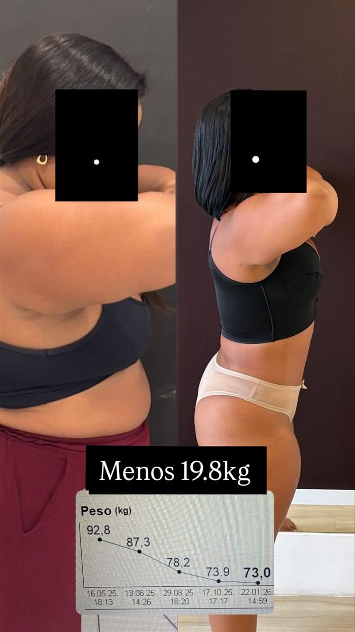 Antes e depois de paciente: menos 19,8 kg