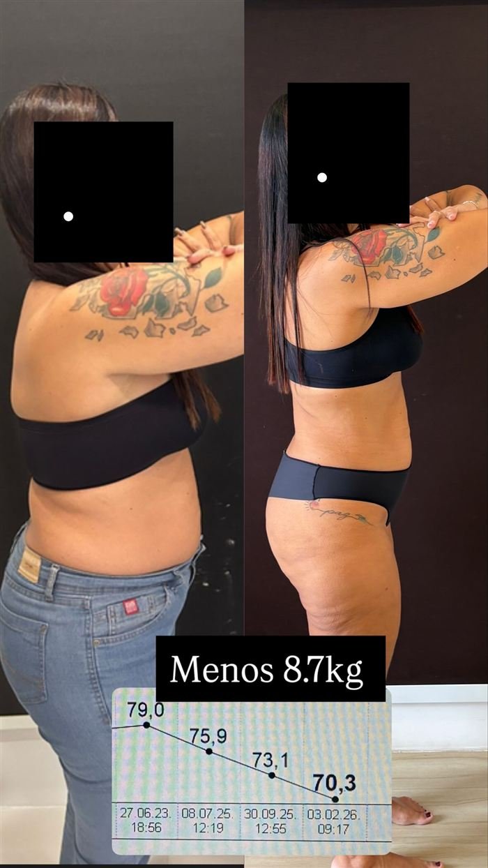 Antes e depois de paciente: menos 8,7 kg