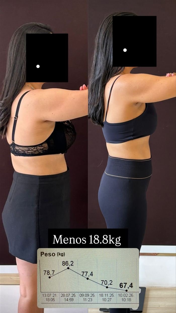 Antes e depois de paciente: menos 18,8 kg