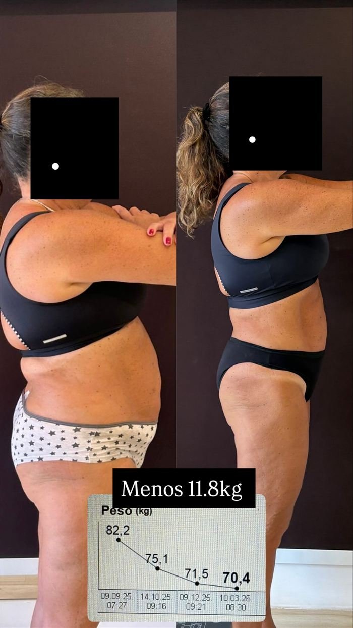 Antes e depois de paciente: menos 11,8 kg