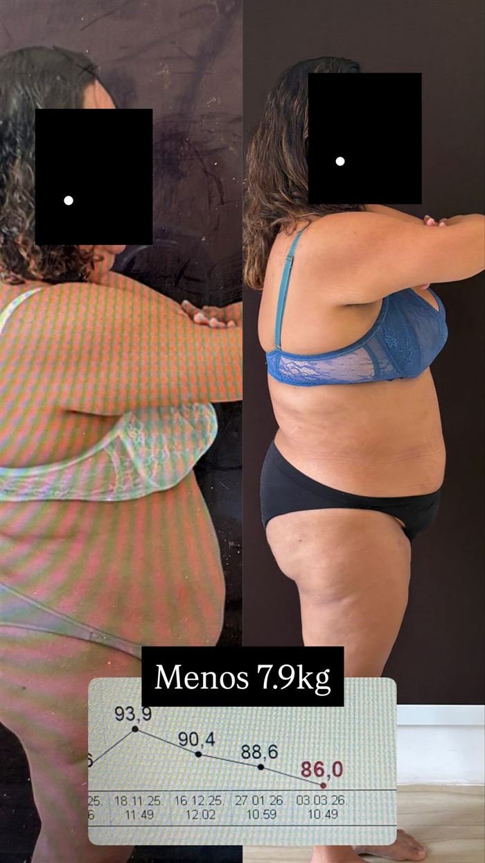 Antes e depois de paciente: menos 7,9 kg