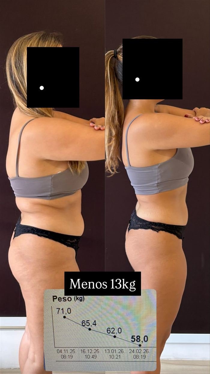 Antes e depois de paciente: menos 13 kg