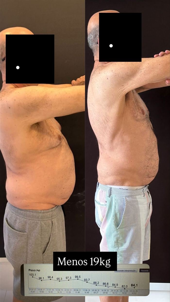 Antes e depois de paciente: menos 19 kg